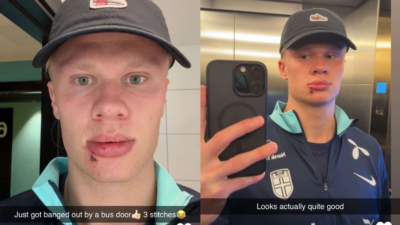 Erling Haaland requires stitches after Norway ‘bus door’ incident Erling Haaland requires stitches after Norway ‘bus door’ incident