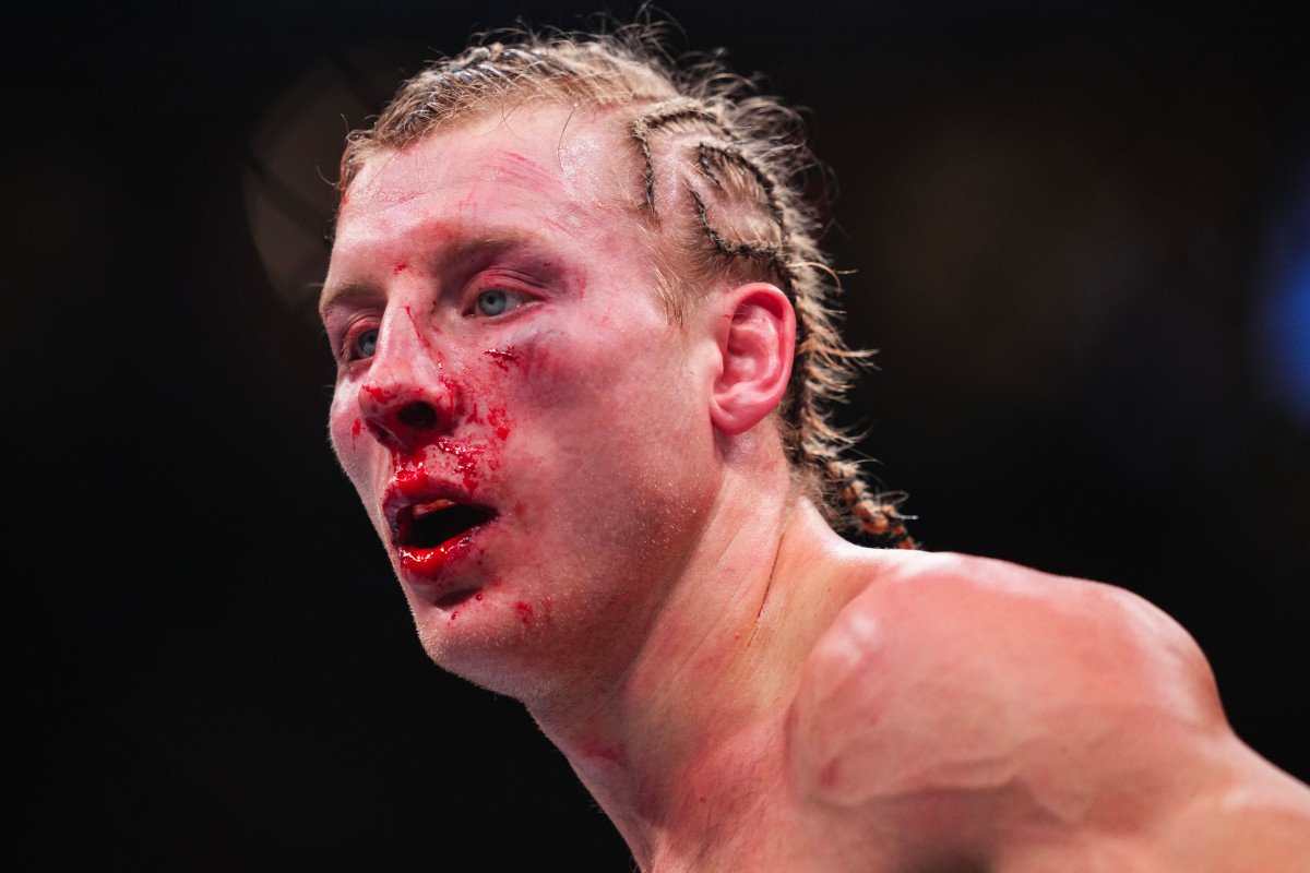 Paddy Pimblett Reflects on UFC 324 Loss and Vows to Regain Championship Gold Paddy Pimblett Reflects on UFC 324 Loss and Vows to Regain Championship Gold