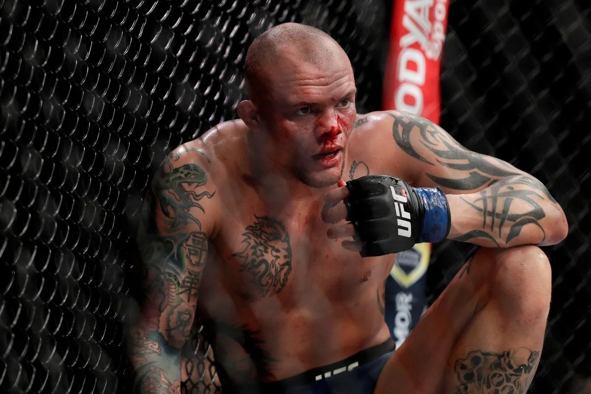 Former UFC title challenger Anthony Smith arrested on felony charges Former UFC title challenger Anthony Smith arrested on felony charges