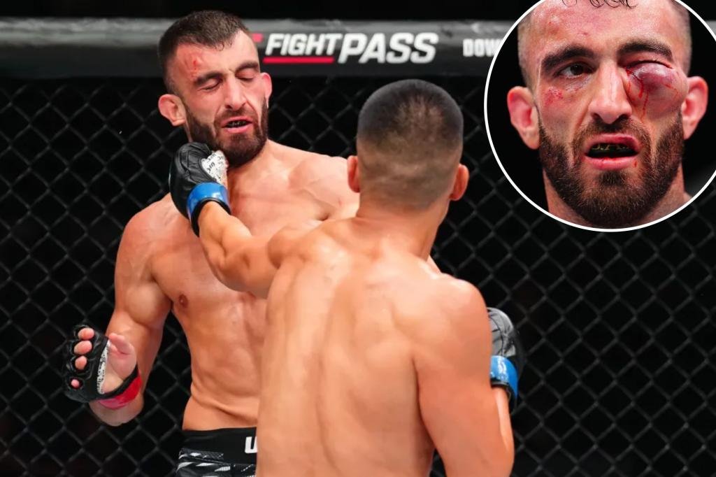 UFC fighter Mohammad Yahya suffers disgusting eye injury UFC fighter Mohammad Yahya suffers disgusting eye injury